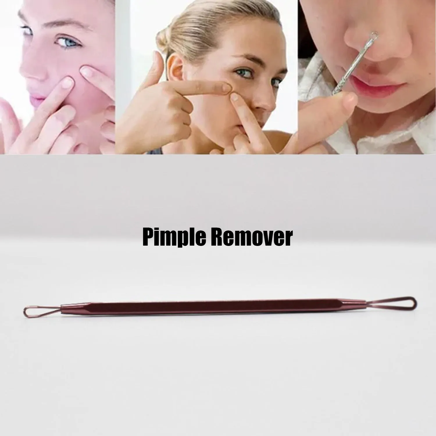 Blackhead Remover Comedone Extractor Tool - Dual Loop Whitehead Blemish Acne Removal - Skin, Facial, Pimple